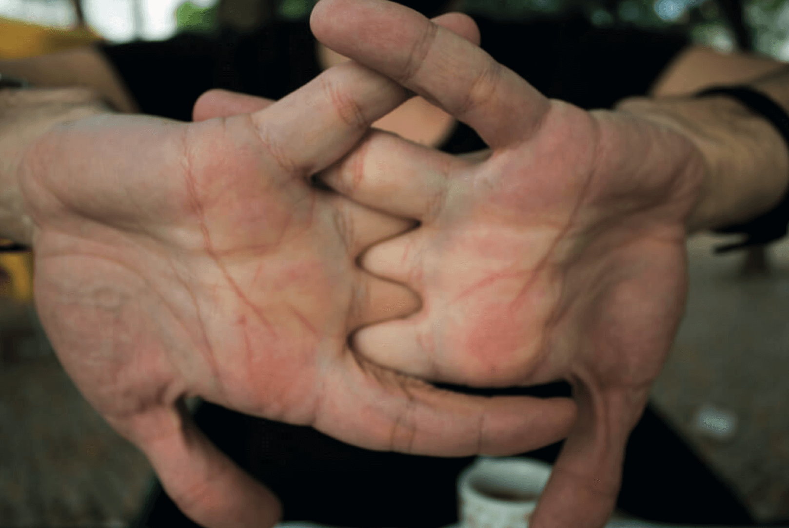 קנאקים באצבעות לא מזיקים או מסוכנים - מדע - מדע פלוס